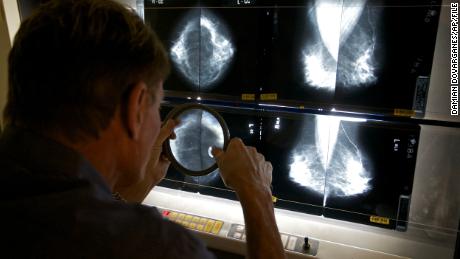 Doctors see advanced cancer cases in the wake of pandemic-delayed screenings and treatment